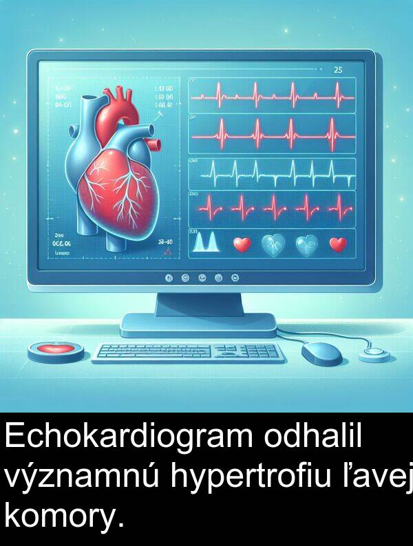 ľavej: Echokardiogram odhalil významnú hypertrofiu ľavej komory.