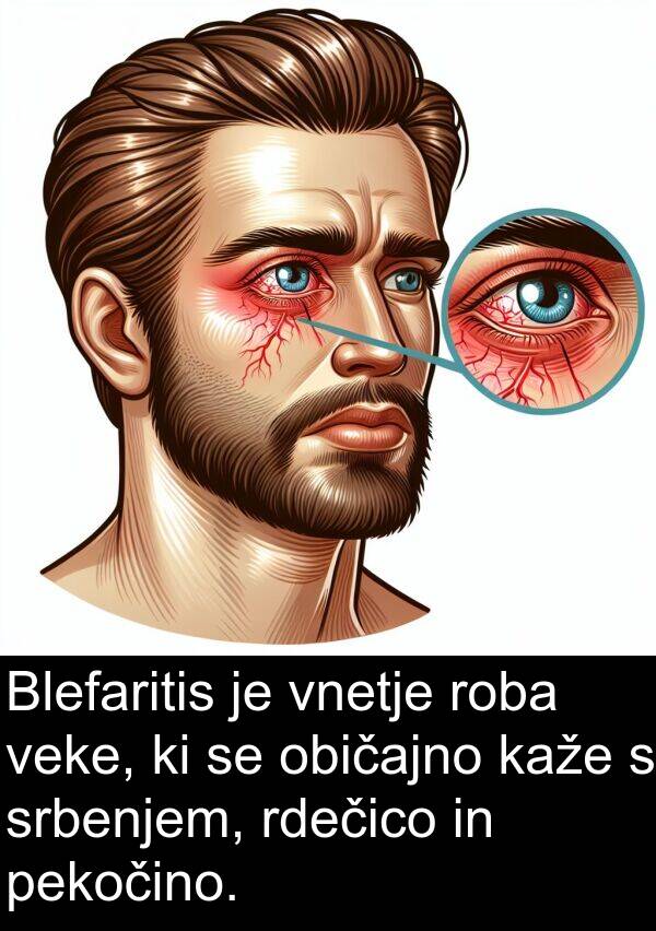 običajno: Blefaritis je vnetje roba veke, ki se običajno kaže s srbenjem, rdečico in pekočino.
