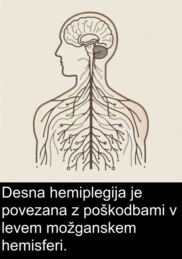 hemiplegija: Desna hemiplegija je povezana z poškodbami v levem možganskem hemisferi.