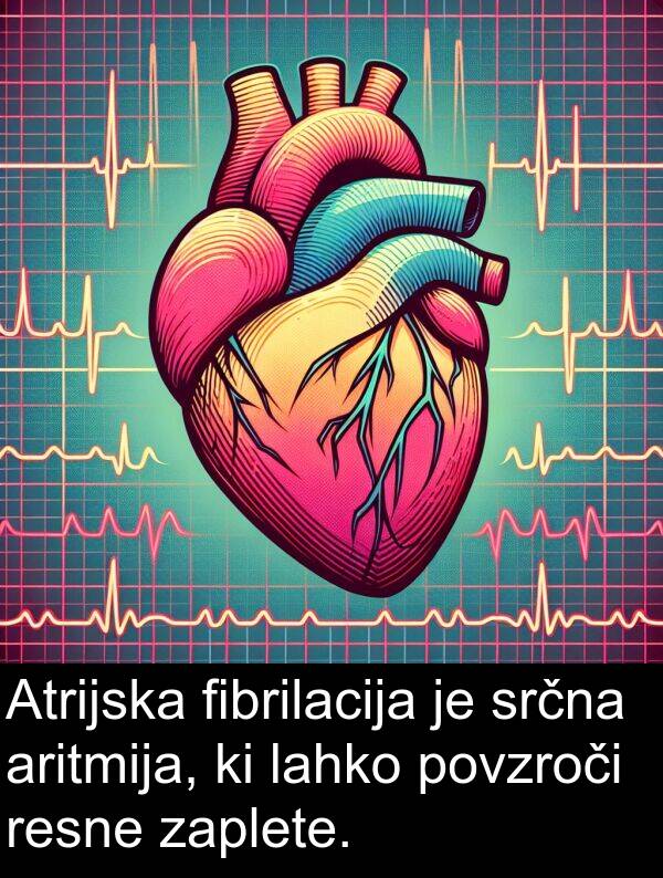 srčna: Atrijska fibrilacija je srčna aritmija, ki lahko povzroči resne zaplete.