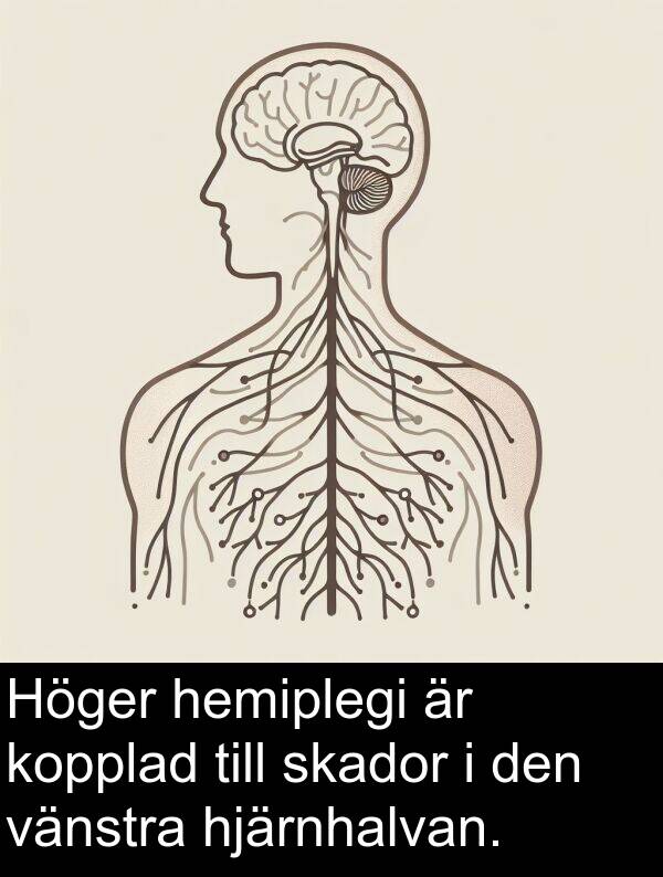 skador: Höger hemiplegi är kopplad till skador i den vänstra hjärnhalvan.