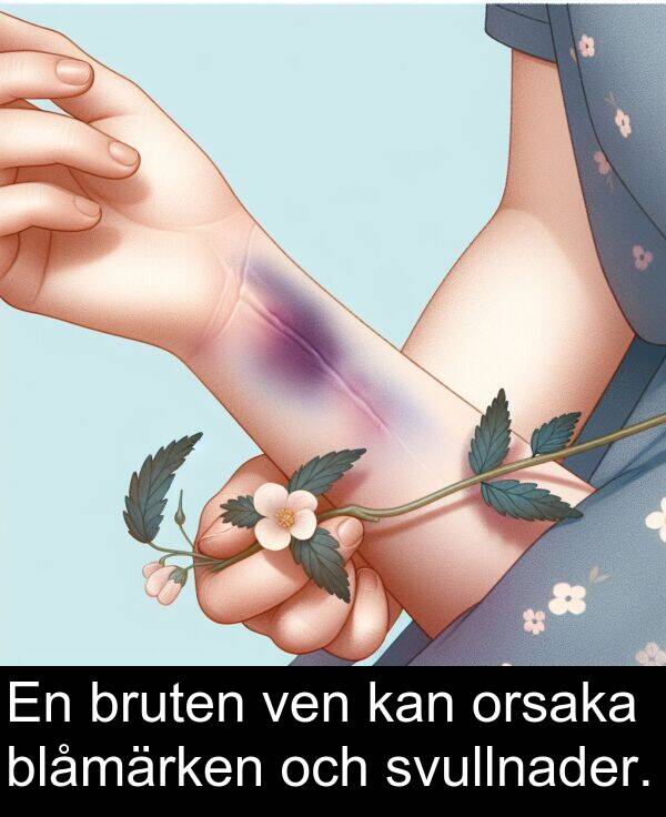 ven: En bruten ven kan orsaka blåmärken och svullnader.
