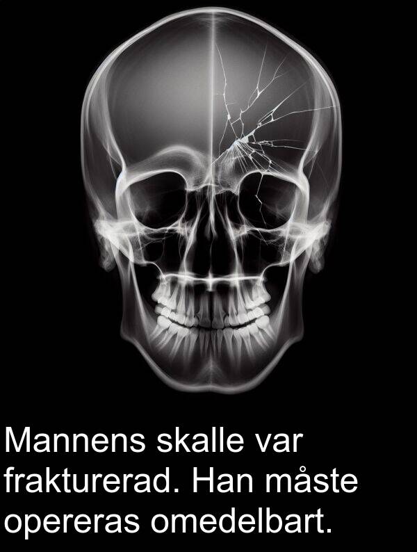 måste: Mannens skalle var frakturerad. Han måste opereras omedelbart.