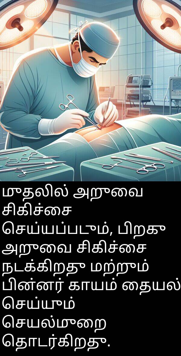 பின்னர்: முதலில் அறுவை சிகிச்சை செய்யப்படும், பிறகு அறுவை சிகிச்சை நடக்கிறது மற்றும் பின்னர் காயம் தையல் செய்யும் செயல்முறை தொடர்கிறது.