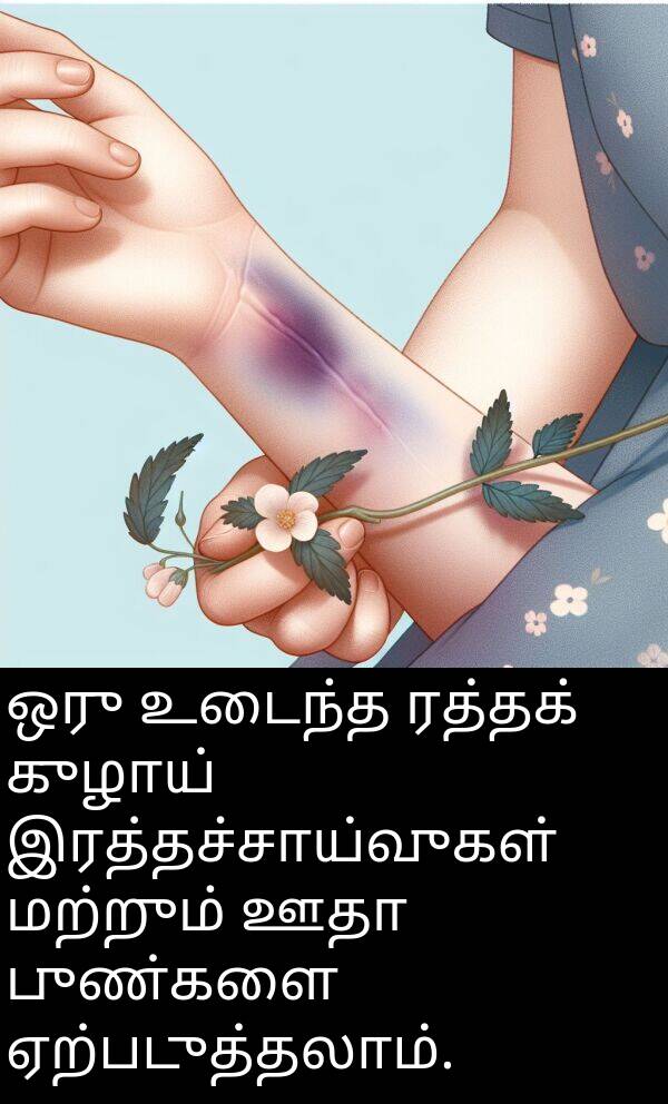 புண்களை: ஒரு உடைந்த ரத்தக் குழாய் இரத்தச்சாய்வுகள் மற்றும் ஊதா புண்களை ஏற்படுத்தலாம்.