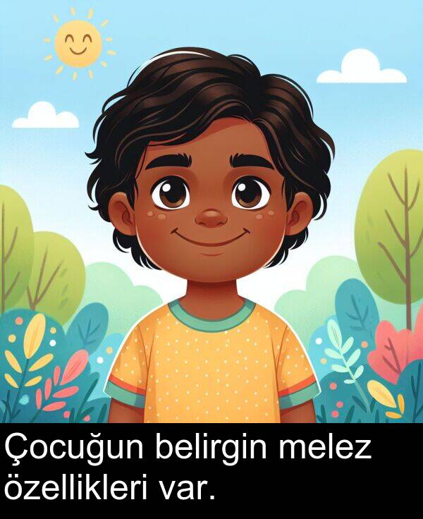 var: Çocuğun belirgin melez özellikleri var.