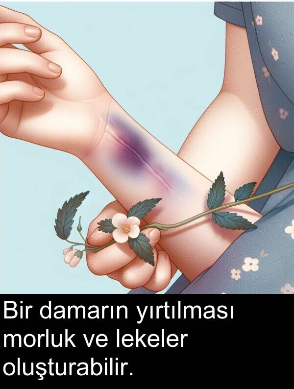 lekeler: Bir damarın yırtılması morluk ve lekeler oluşturabilir.