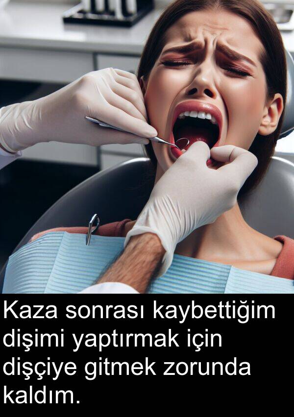 kaldım: Kaza sonrası kaybettiğim dişimi yaptırmak için dişçiye gitmek zorunda kaldım.