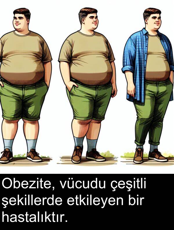 vücudu: Obezite, vücudu çeşitli şekillerde etkileyen bir hastalıktır.
