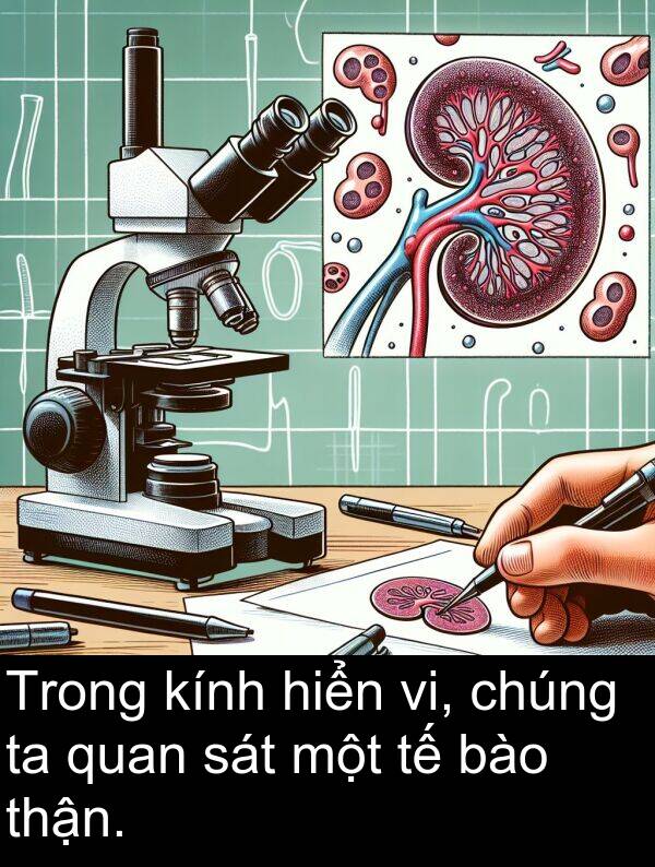 thận: Trong kính hiển vi, chúng ta quan sát một tế bào thận.