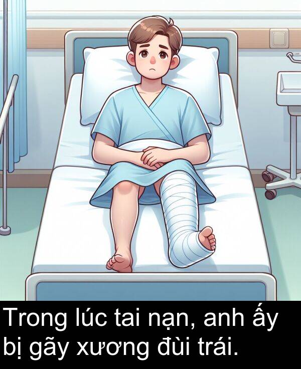 đùi: Trong lúc tai nạn, anh ấy bị gãy xương đùi trái.